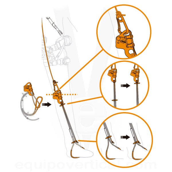 Estribo pedal FOOTLOOP para bloqueador de rodilla con método SRT 2